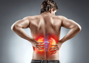 Man holding his back in pain due to a kidney infection.