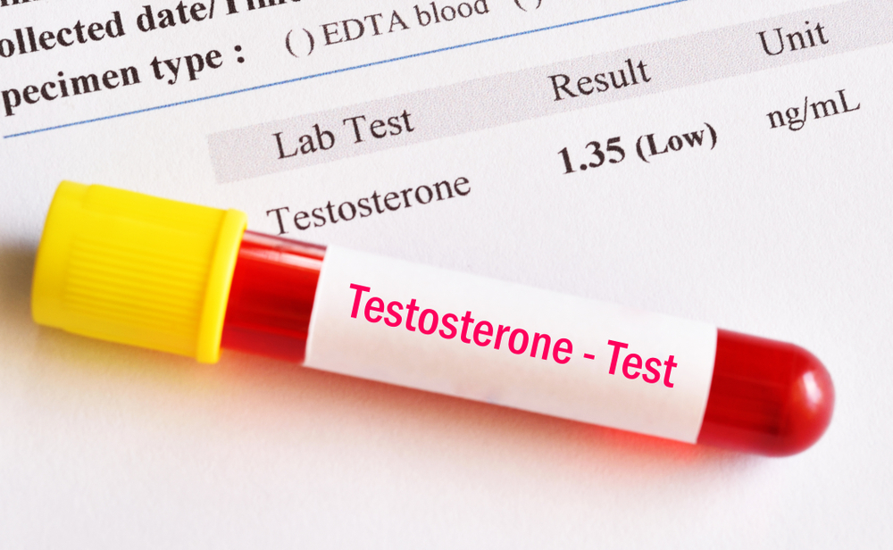 Vial of blood from testosterone test next to negative results
