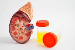 Blood In Urine